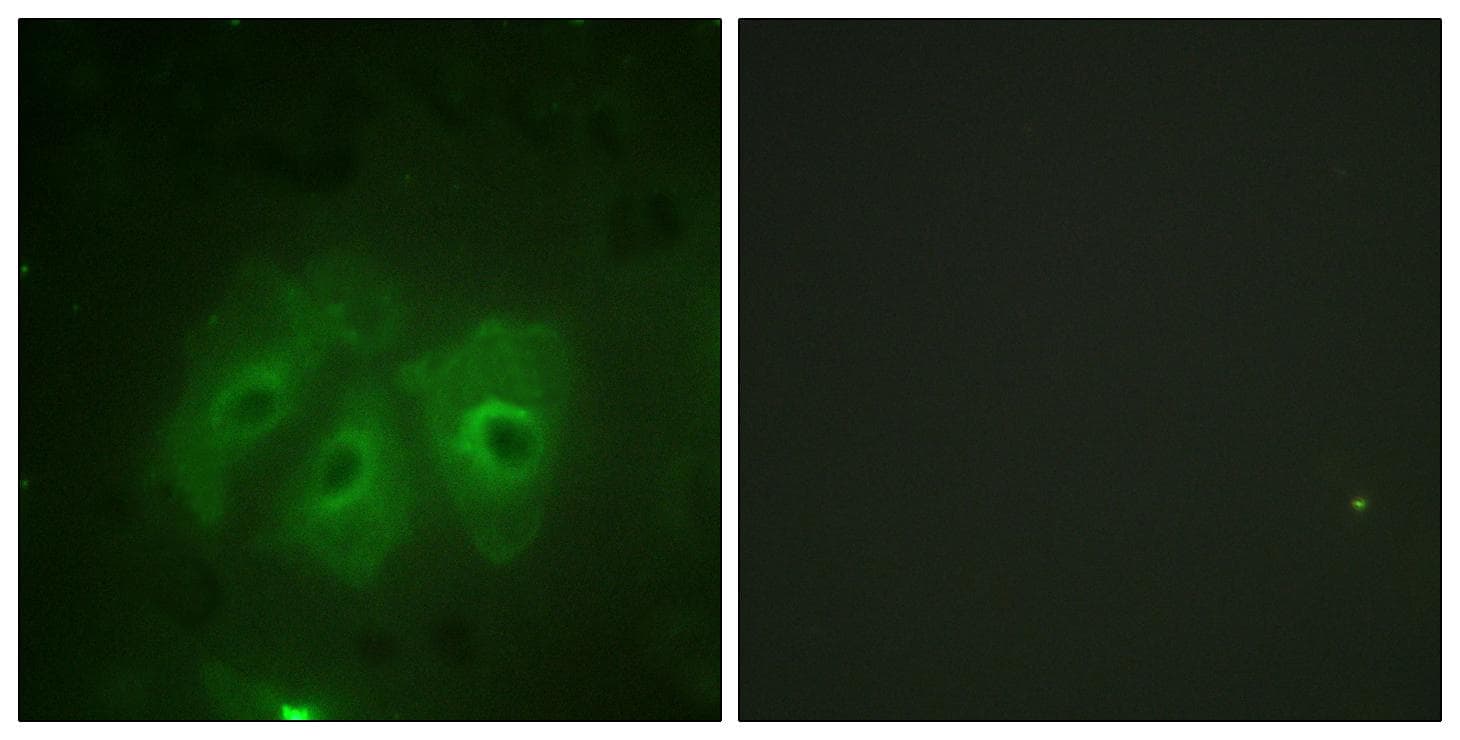 NCF1 / p47phox / p47 phox Antibody (phospho-Ser359)