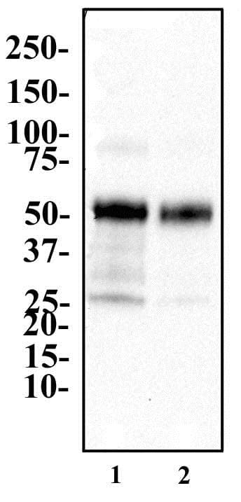 Polyclonal Rabbit anti-Human PPARG / PPAR Gamma Antibody (aa20-120, IHC, WB)