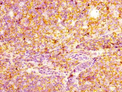 CD44 Antibody