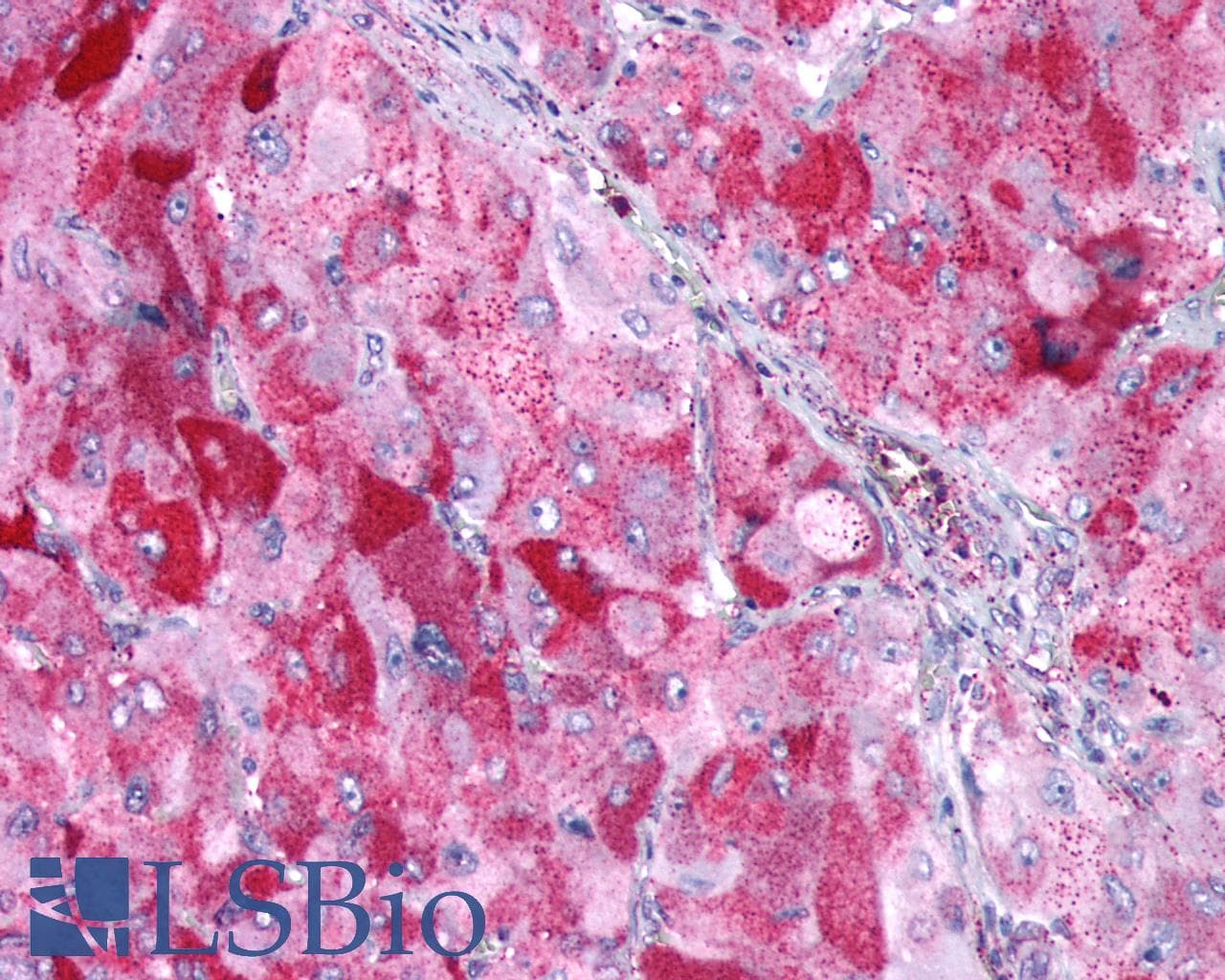 IHC-plus™ GIPR / GIP Receptor Antibody (N-Terminus)