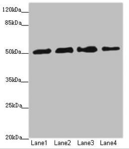 Polyclonal Rabbit anti-Human CALCOCO2 Antibody (IHC, WB)