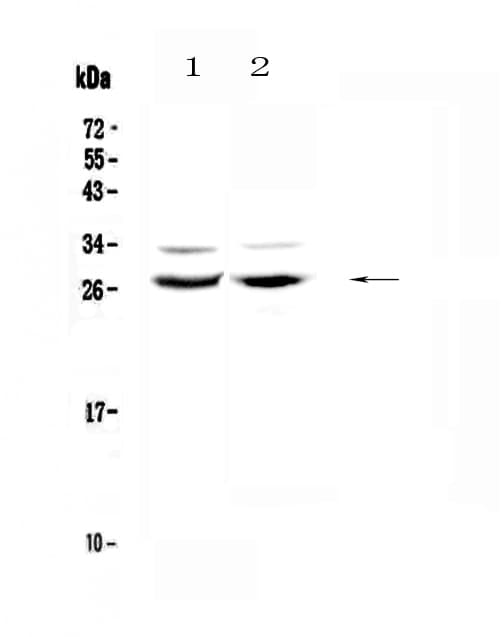 Polyclonal Rabbit anti-Human MXD1 / MAD1 Antibody (WB)