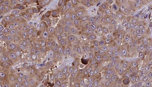 ADGRD1 / GPR133 Antibody