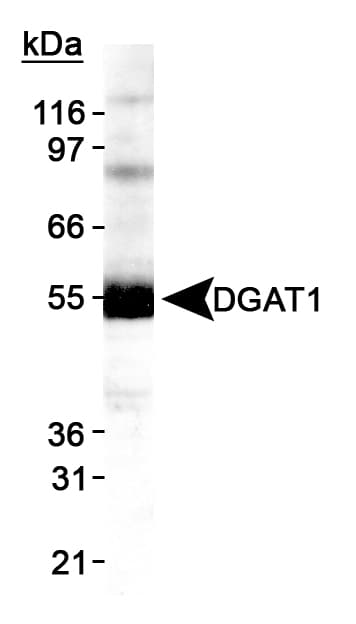 DGAT1 Antibody (aa200-300)