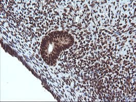 VHL / Von Hippel Lindau Antibody (clone OTI1E1)