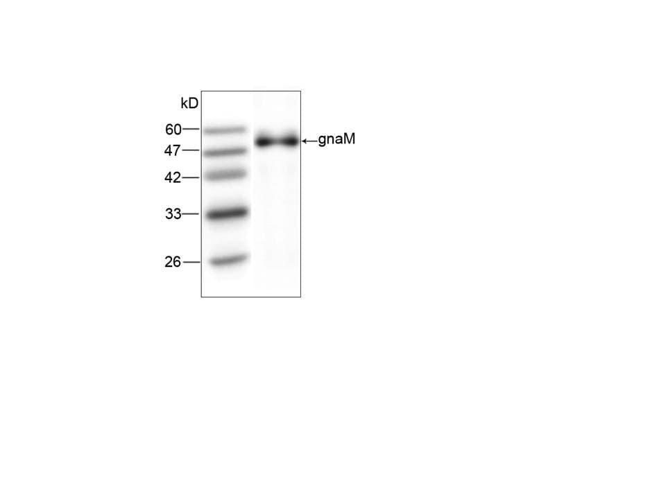 Neisseria meningitidis gna2132 Antibody (aa86-282)