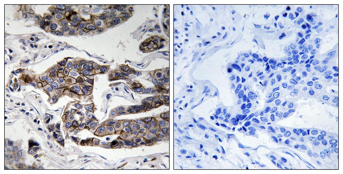 CCDC88A / GIV / Girdin Antibody (phospho-Ser1417)
