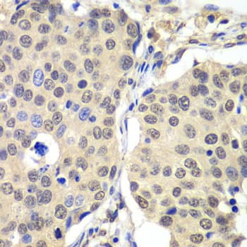 CCNC / Cyclin C Antibody