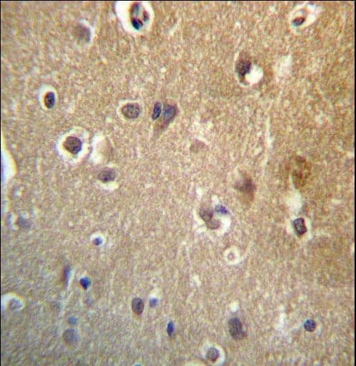 HDAC3 Antibody (aa383-412)