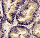 Polyclonal Rabbit anti-Human VEGFB Antibody (aa110-139, IHC, WB)