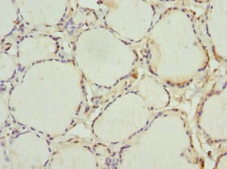 INHBC Antibody