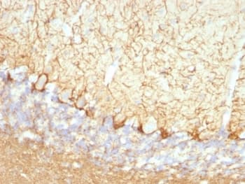 Neurofilament Antibody (clone NFL/736)
