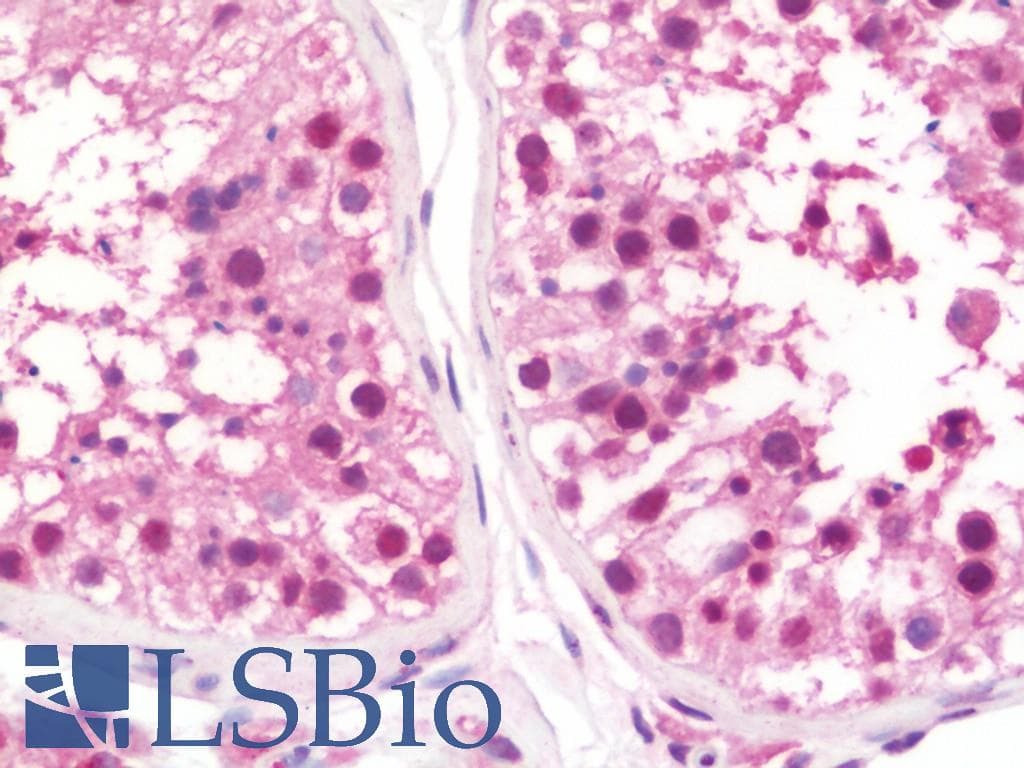 IHC-plus™ HT2A / TRIM32 Antibody (aa1-289)