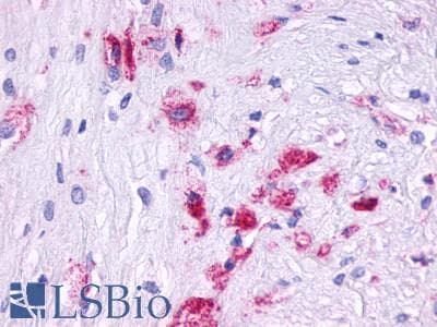 PathPlus™ Polyclonal Rabbit anti-Human LPAR6 / P2RY5 / P2Y5 Antibody (C-Terminus, IHC)