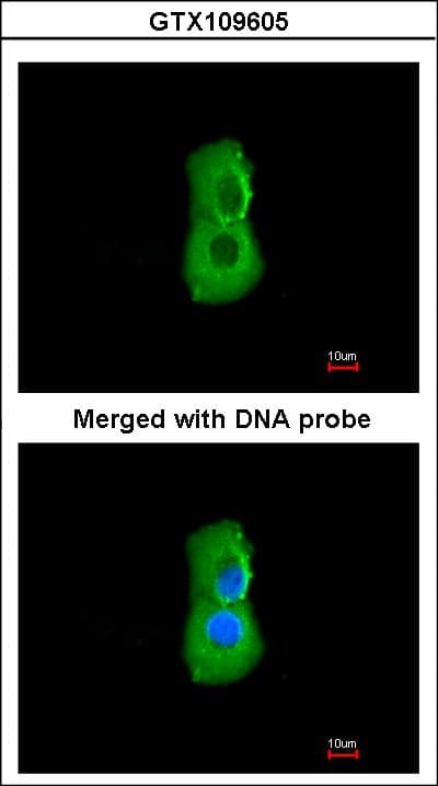PSMC3 Antibody (aa51-361)