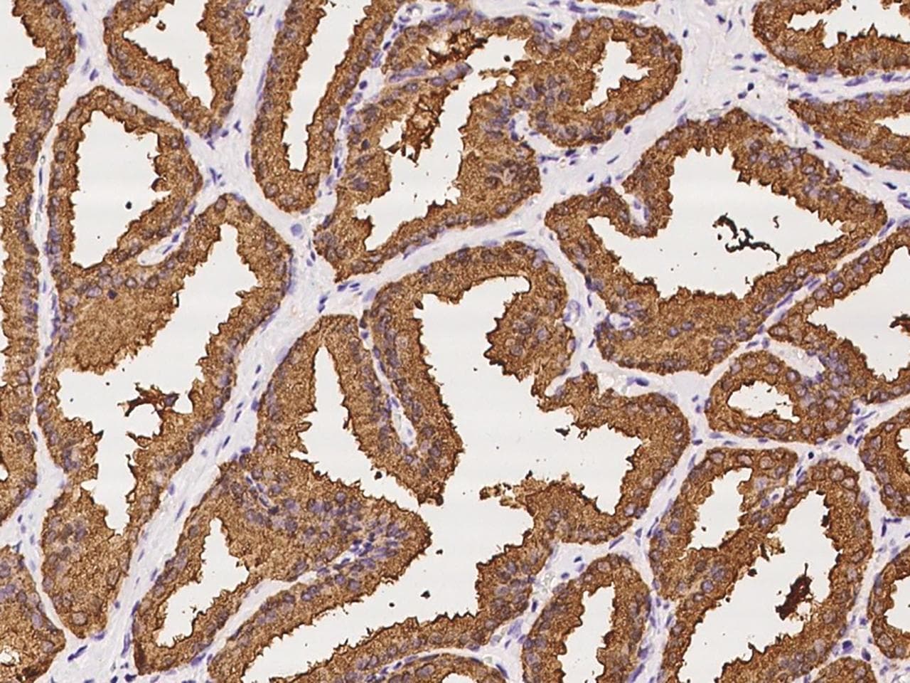 MSMB / MSP Antibody