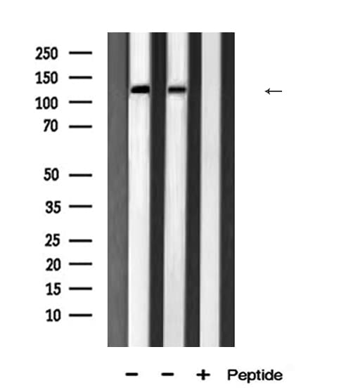 JMY Antibody