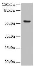 Polyclonal Rabbit anti-Human DENND2D Antibody (WB)