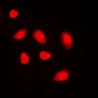 Polyclonal Rabbit anti-Human MUTYH / MYH Antibody (Internal, IHC, IF, WB)
