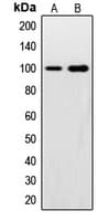 SNCAIP / Synphilin 1 Antibody (C-Terminus)