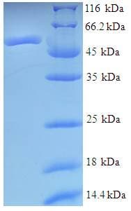 Human ASNA1 Protein (Recombinant His-SUMO)