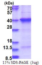 Human THAP7 Protein (Recombinant His)