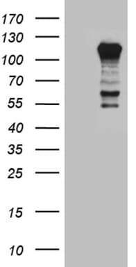 PTPN22 / PEP Antibody (aa359-449, clone OTI6B1)