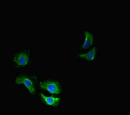 Polyclonal Rabbit anti-Human THADA Antibody (IHC, IF)