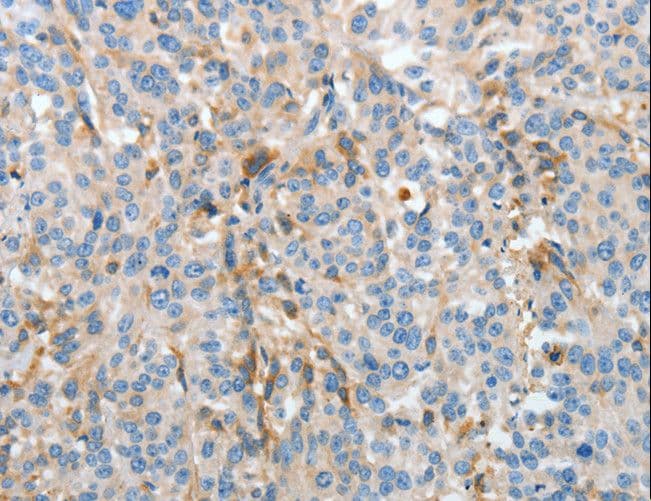 Polyclonal Rabbit anti-Human APOH / Apolipoprotein H Antibody (aa21-226, IHC, WB)