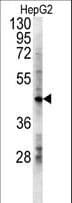 LDHD / Lactate Dehydrogenase D Antibody (aa35-62)