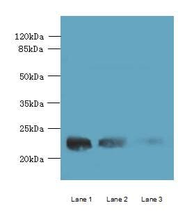 WDYHV1 Antibody (N-Terminus)