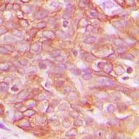 CLDN3 / Claudin 3 Antibody (C-Terminus)