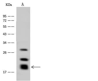 GM2A Antibody (Preservative Free)