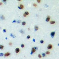 DYRK1B Antibody (Internal)
