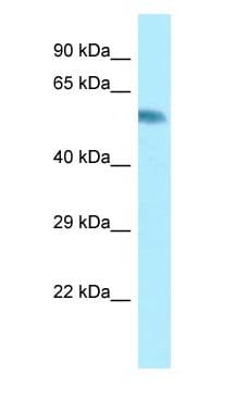 Polyclonal Rabbit anti-Human CYP2A6 Antibody (aa352-401, WB)