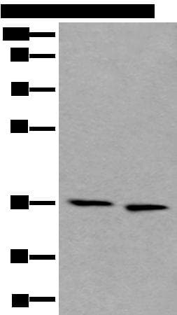 Polyclonal Rabbit anti-Human CDC123 Antibody (WB)