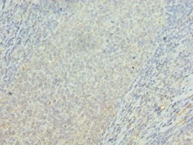 OSBPL2 Antibody