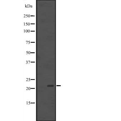 BCL7B Antibody