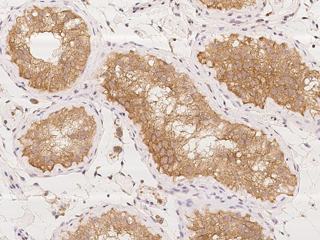 CCT5 / TCP1 Epsilon Antibody