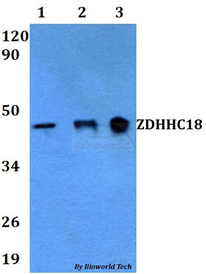 Polyclonal Rabbit anti-Human ZDHHC18 Antibody (WB)