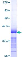 Human Spastin Protein (Recombinant GST, N-terminus)
