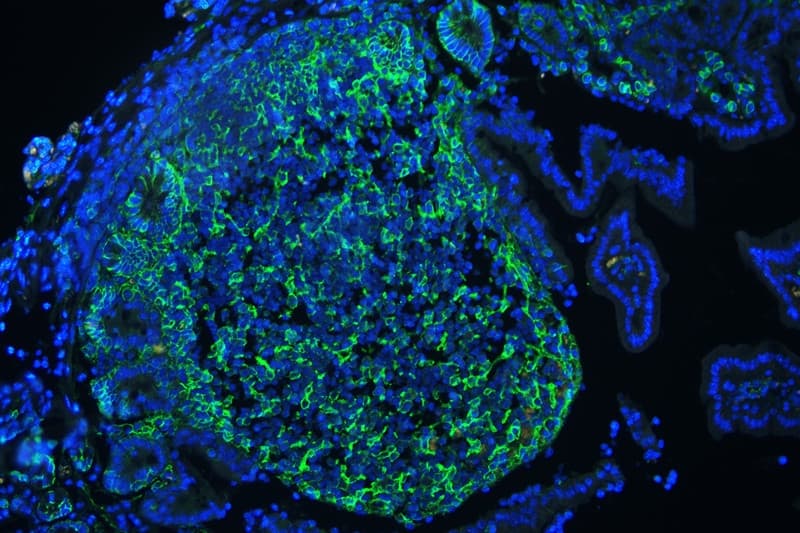 CD44 Antibody