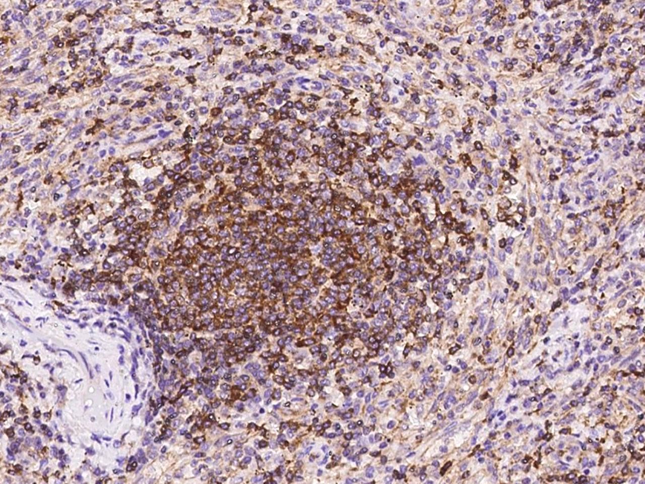 IL16 Antibody