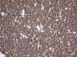 CD20 Antibody (clone OTI2D3, Carrier-free)