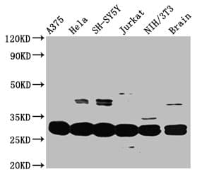 YWHAE / 14-3-3 Epsilon Antibody