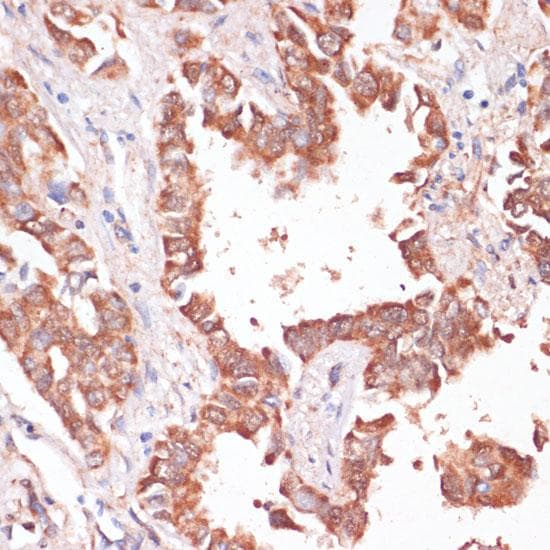 KCNH2 / HERG Antibody