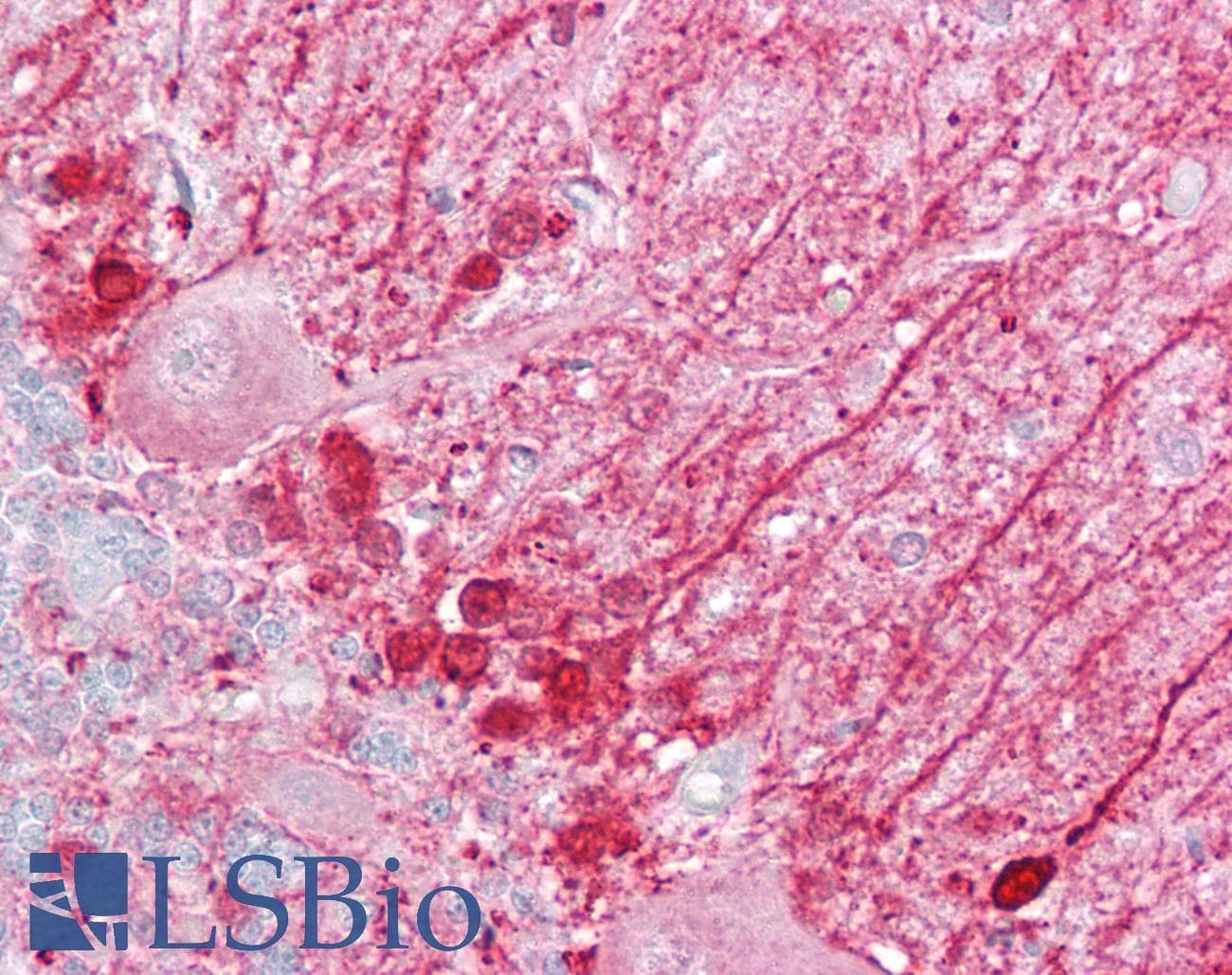 DBI / ACBD1 Antibody (N-Terminus)