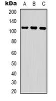 RFWD2 / COP1 Antibody (phospho-Ser387)