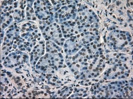HSPA9 / Mortalin / GRP75 Antibody (clone OTI9F8)