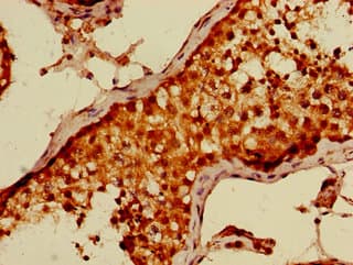DTL / CDT2 Antibody
